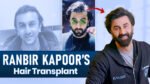 Ranbir Kapoor hair transplant discussion exploring the difference between confirmed facts and speculation about changes in his hairline.