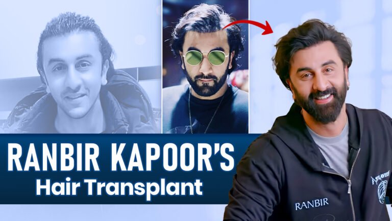 Ranbir Kapoor hair transplant discussion exploring the difference between confirmed facts and speculation about changes in his hairline.