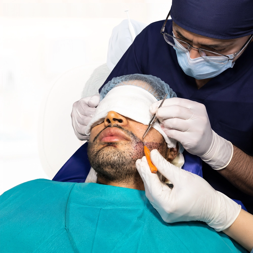 Beard Moustache Hair Transplant