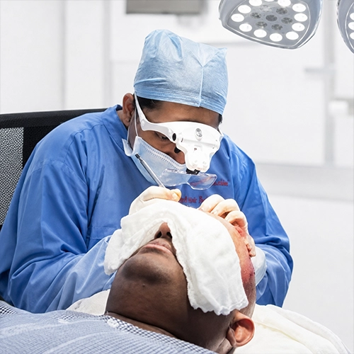 Failed Hair Transplant Repair