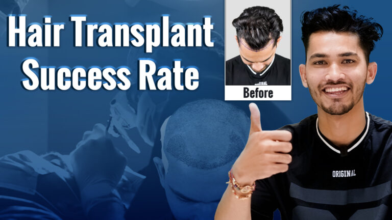 Hair transplant success rate showing a hair transplant procedure and before-and-after hair restoration results.