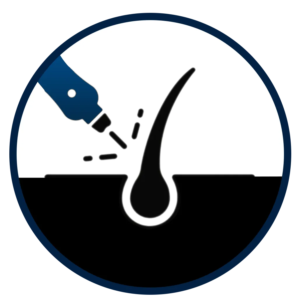 Hair follicle icon representing BIG-FUE, Implanter FUE and Bio-FUE hair transplant techniques