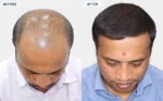 hair transformation results