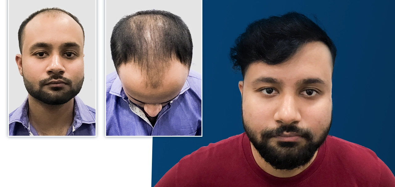 CHIRANTAN KUMAR MANDAL