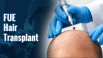 FUE Hair Transplant in India: Procedure, Recovery and Cost